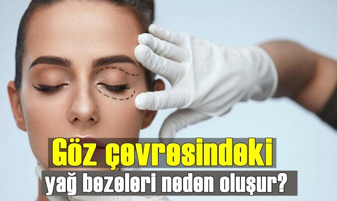 Göz altı yağları